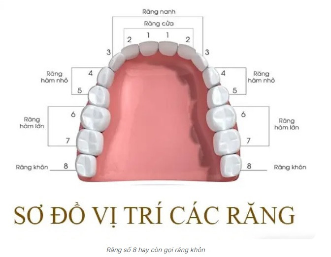 Nhổ răng số 8 có nguy hiểm không?